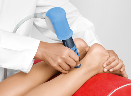 Shockwave therapy Achilles tendinopathy (mid-portion)