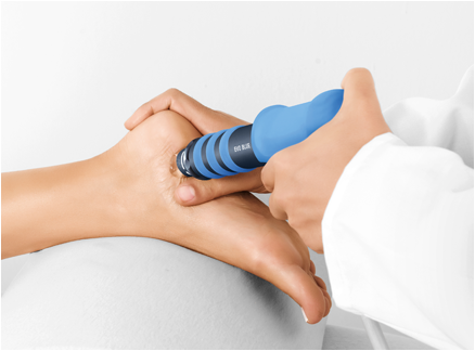 Shockwave therapy for plantar fasciitis heel pain - Glasgow Physio Effect