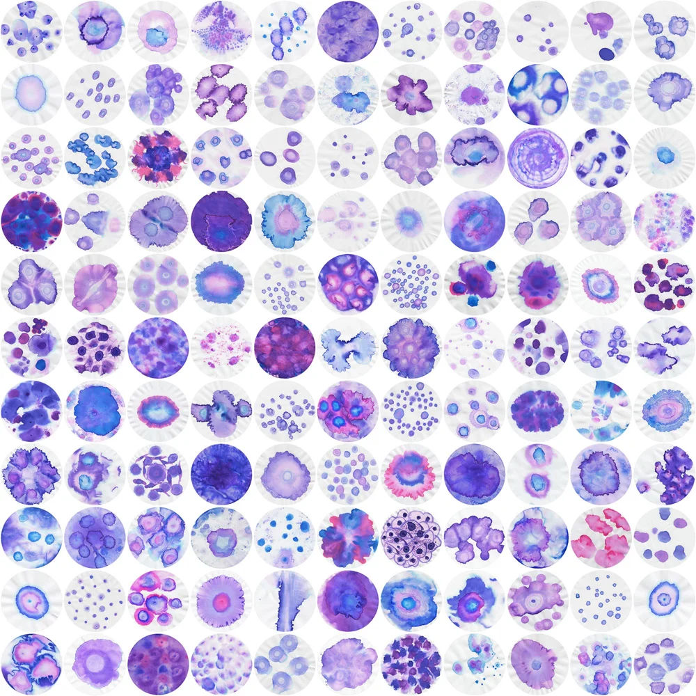Image description; an 11 x 11 array of 121 circular ink patterns made with mixtures of blue and pink ink. The patterns represent the more than 120 types of brain tumours derived from neuronal and glial cells.