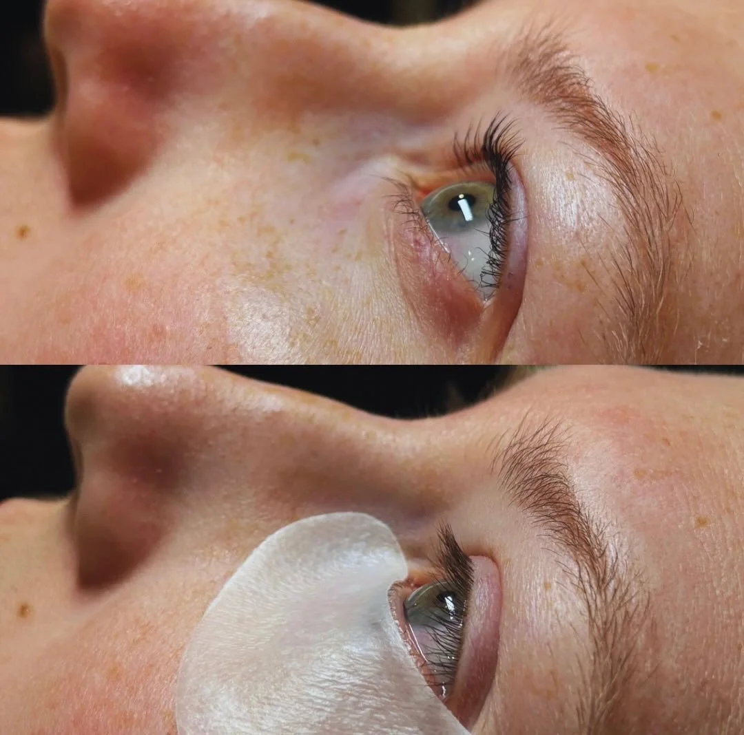 Lash lift + tint = 6&ndash;8 weeks of perfectly curled, darker lashes 💖

#lashliftandtint #lashlift #lashlove #naturallashes #liftedlashes #lashgoals #lashtransformation #lowmaintenancelashes #mascarafree #lashcurl