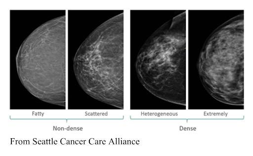 Dense Breasts Canada on LinkedIn: As you can see in the picture, the more  dense tissue, the harder it is for…