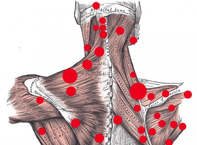 bodyworkneuromusculartherapy.jpg