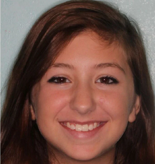 Britney P. After Orthodontic Treatment