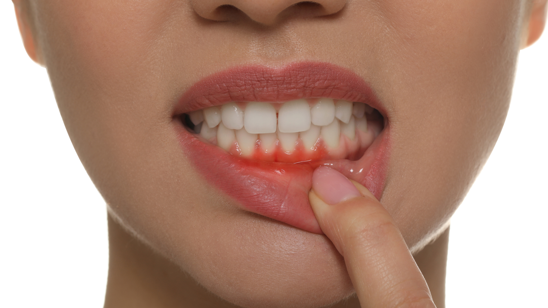 Best Option for Gum Recession