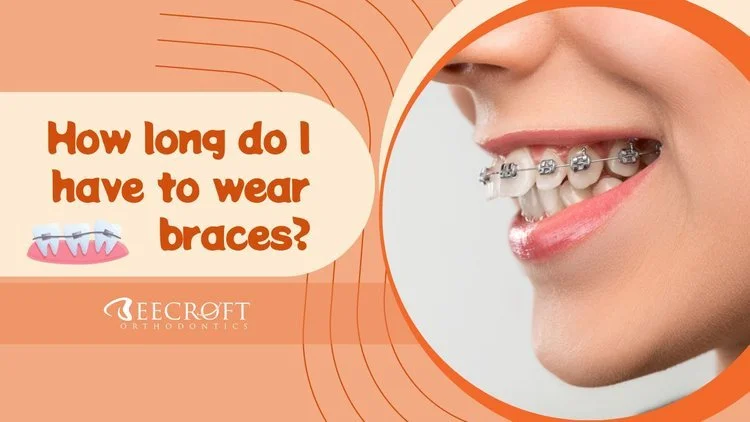 How Long Should You Wear Braces?