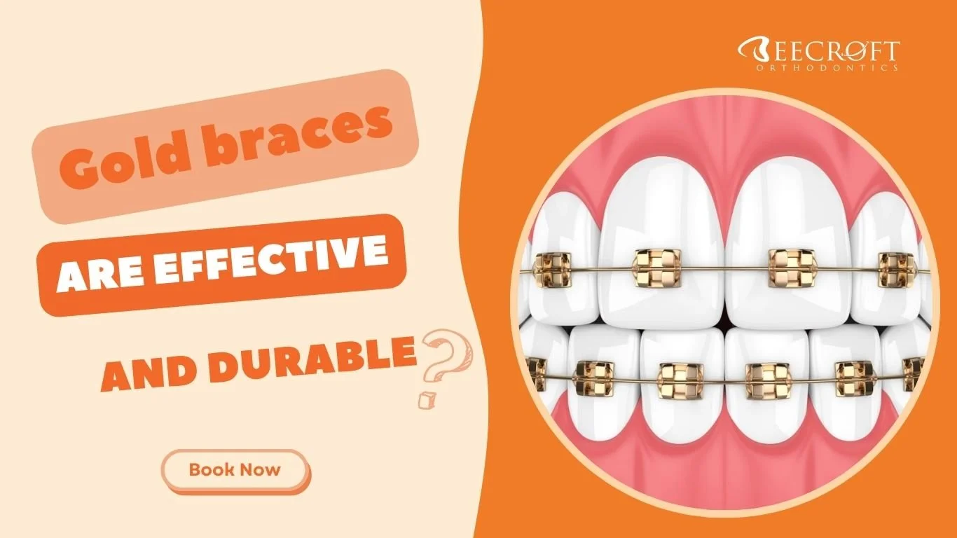 Gold Braces are Effective and Durable? — Beecroft Orthodontics
