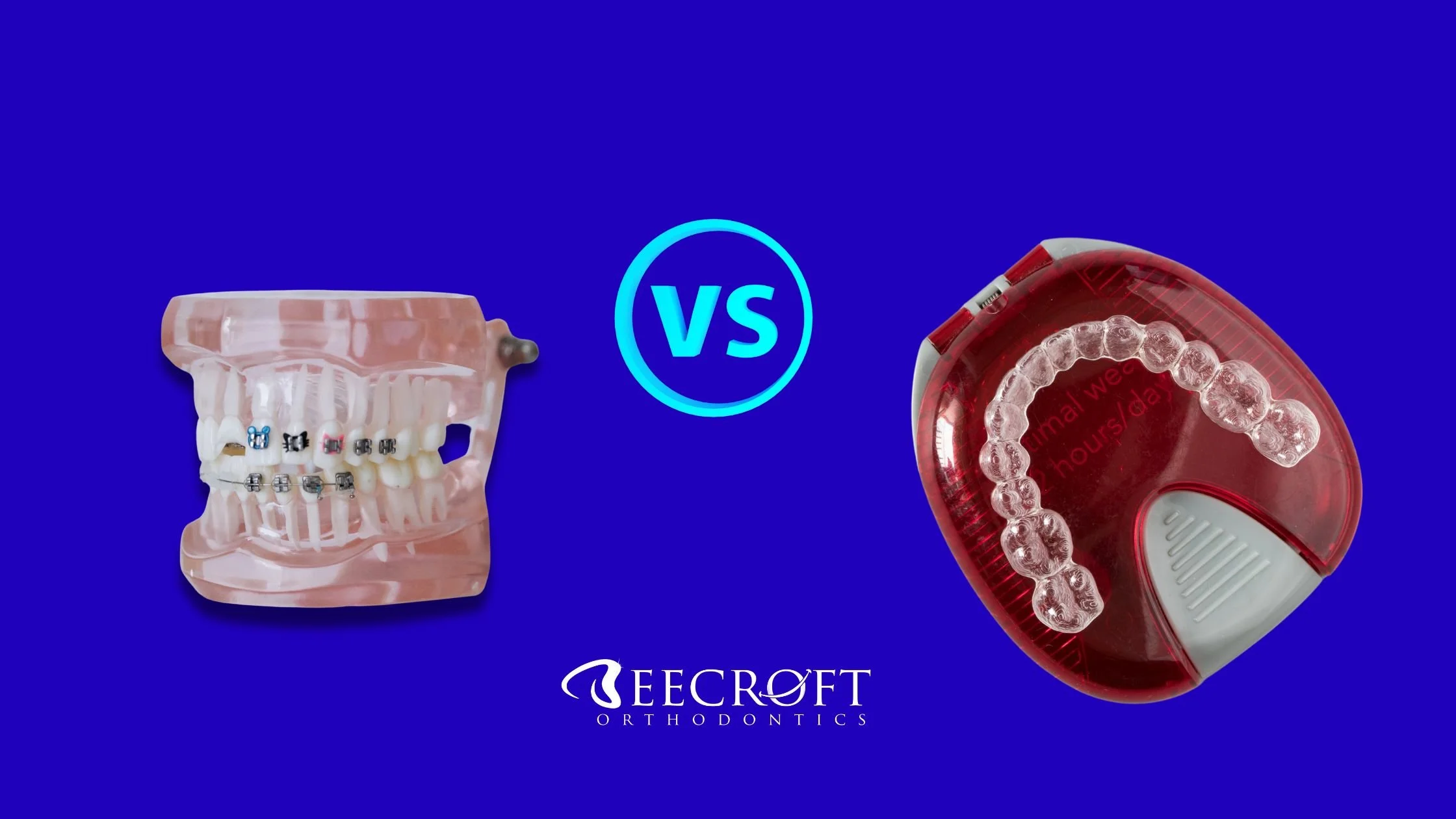 Braces vs. Invisalign in 2025: What’s New and What’s Best for You?