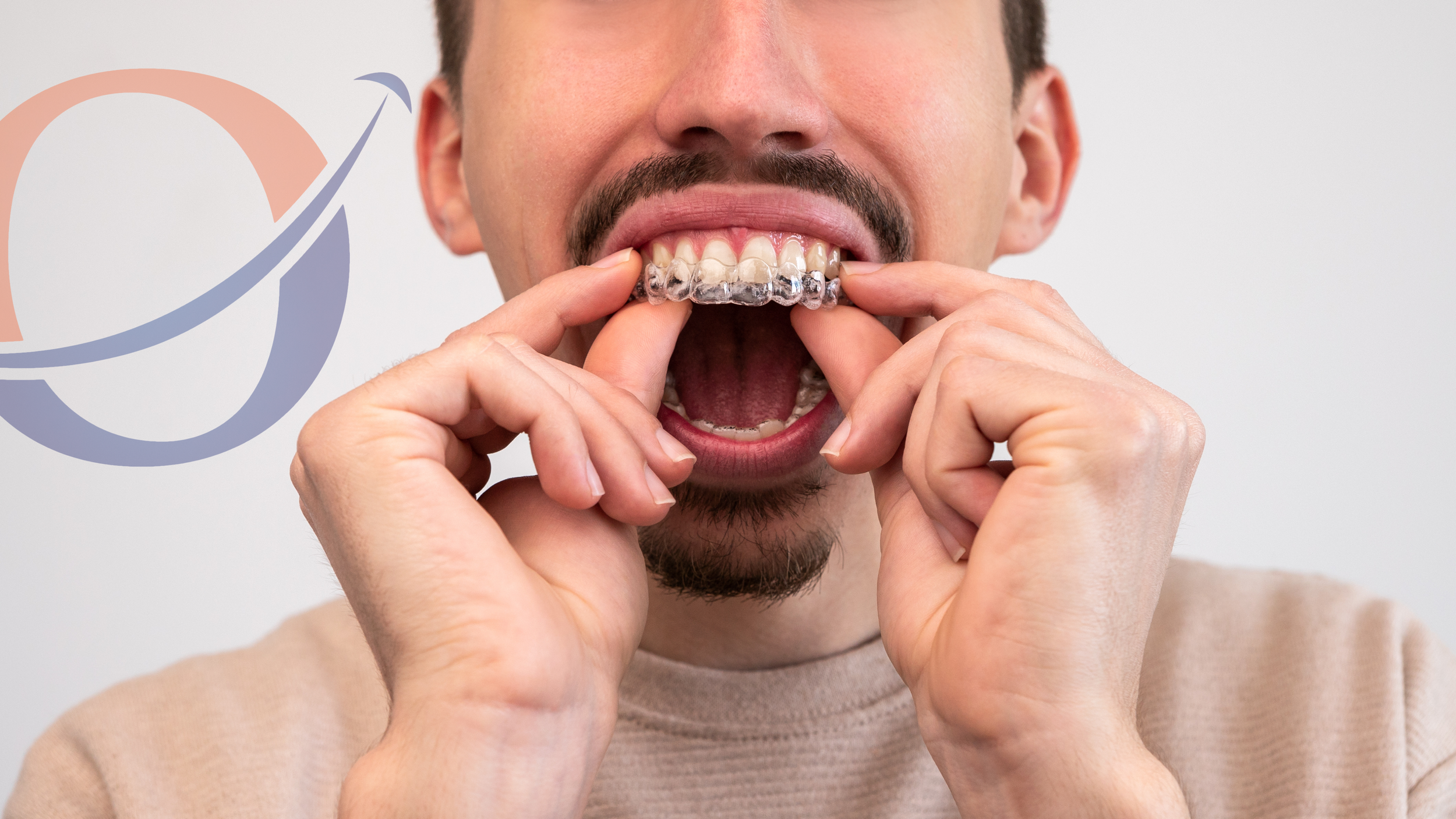 How to Tell If Your Retainer Fits Properly