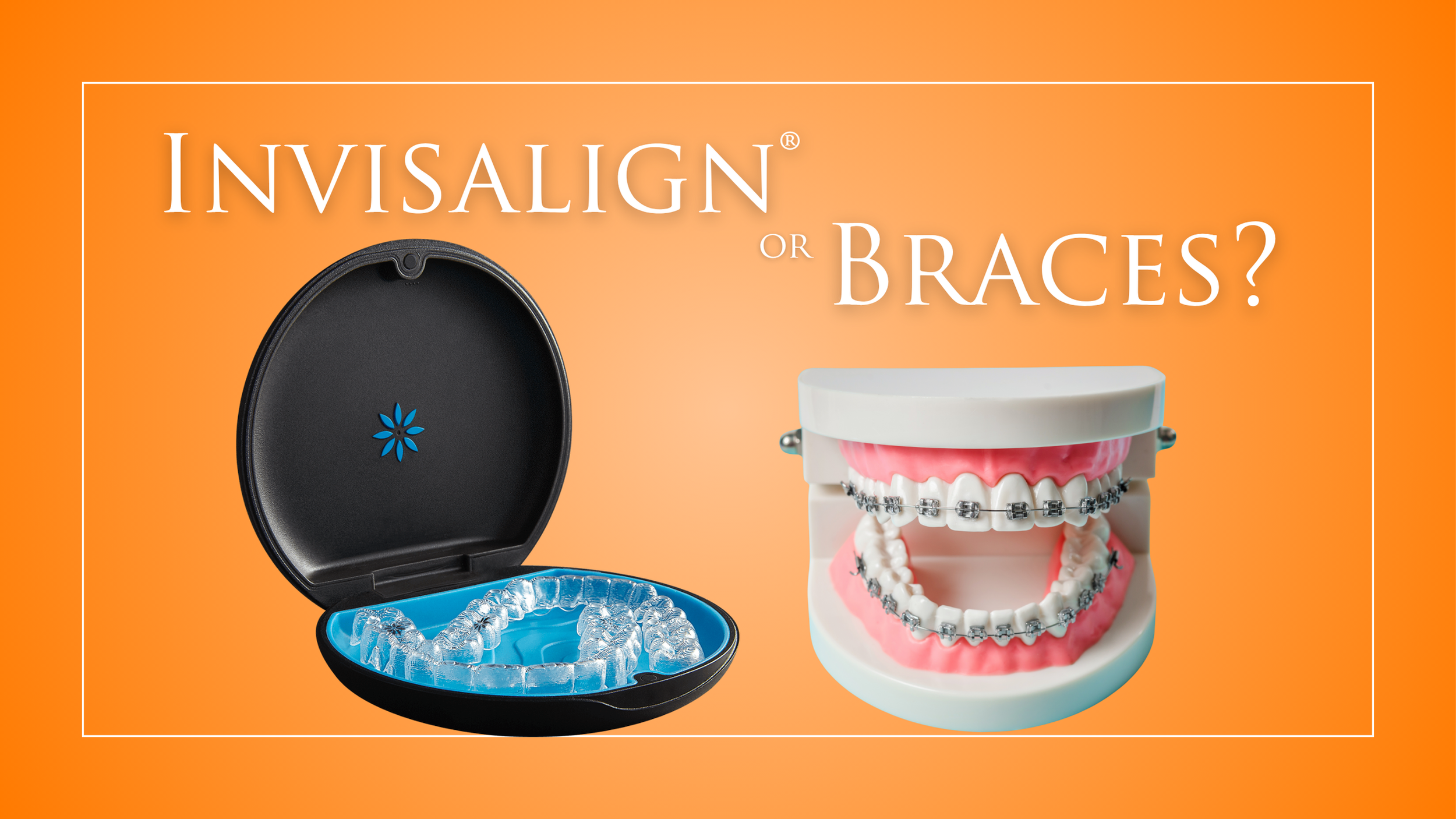 Should I Get Braces or Invisalign? Take This Quiz