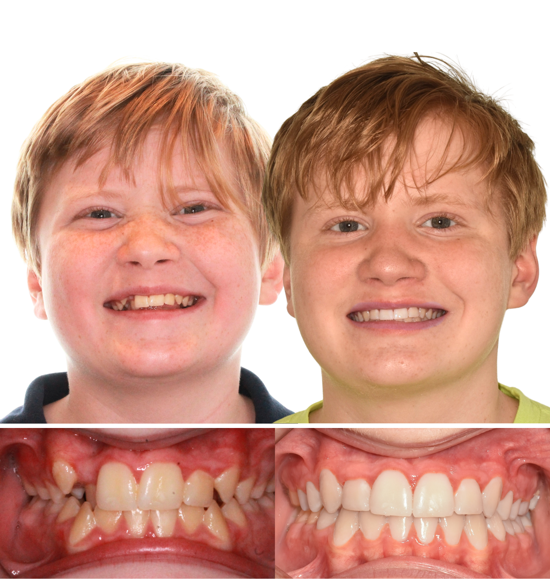 before+and+after+webstie.png