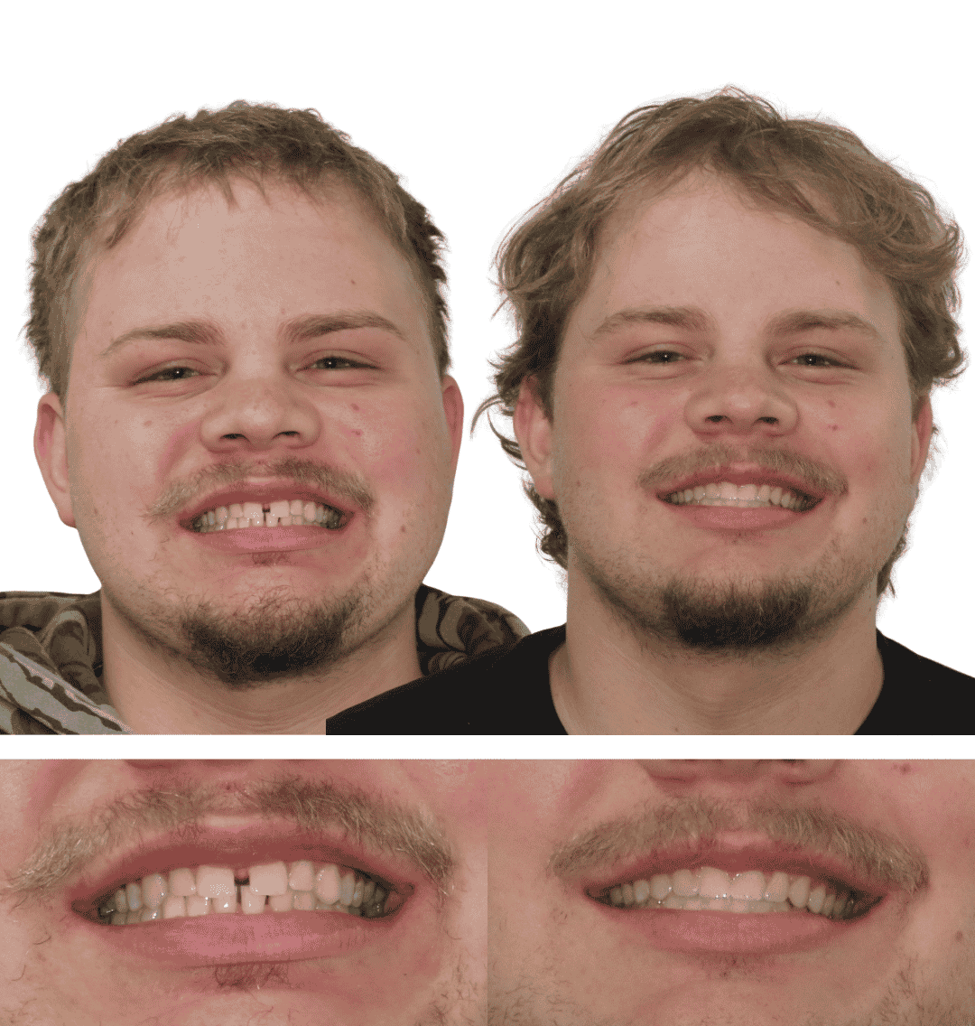 5.png