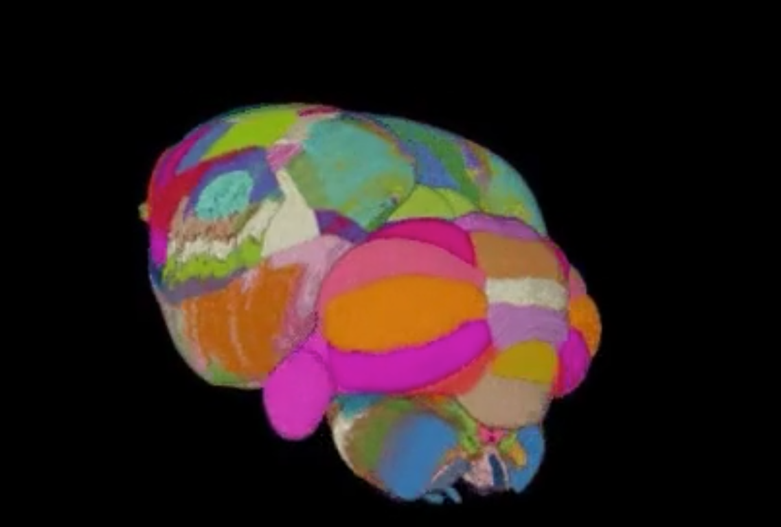 brain image.png