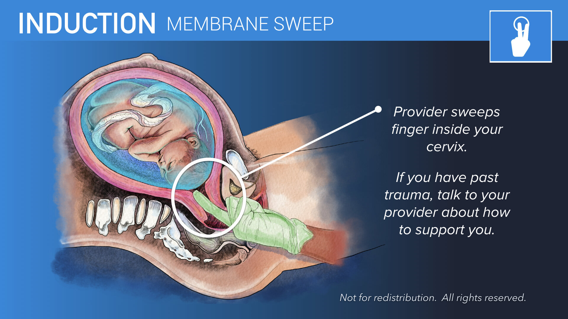 Membrane Sweep.001.jpeg