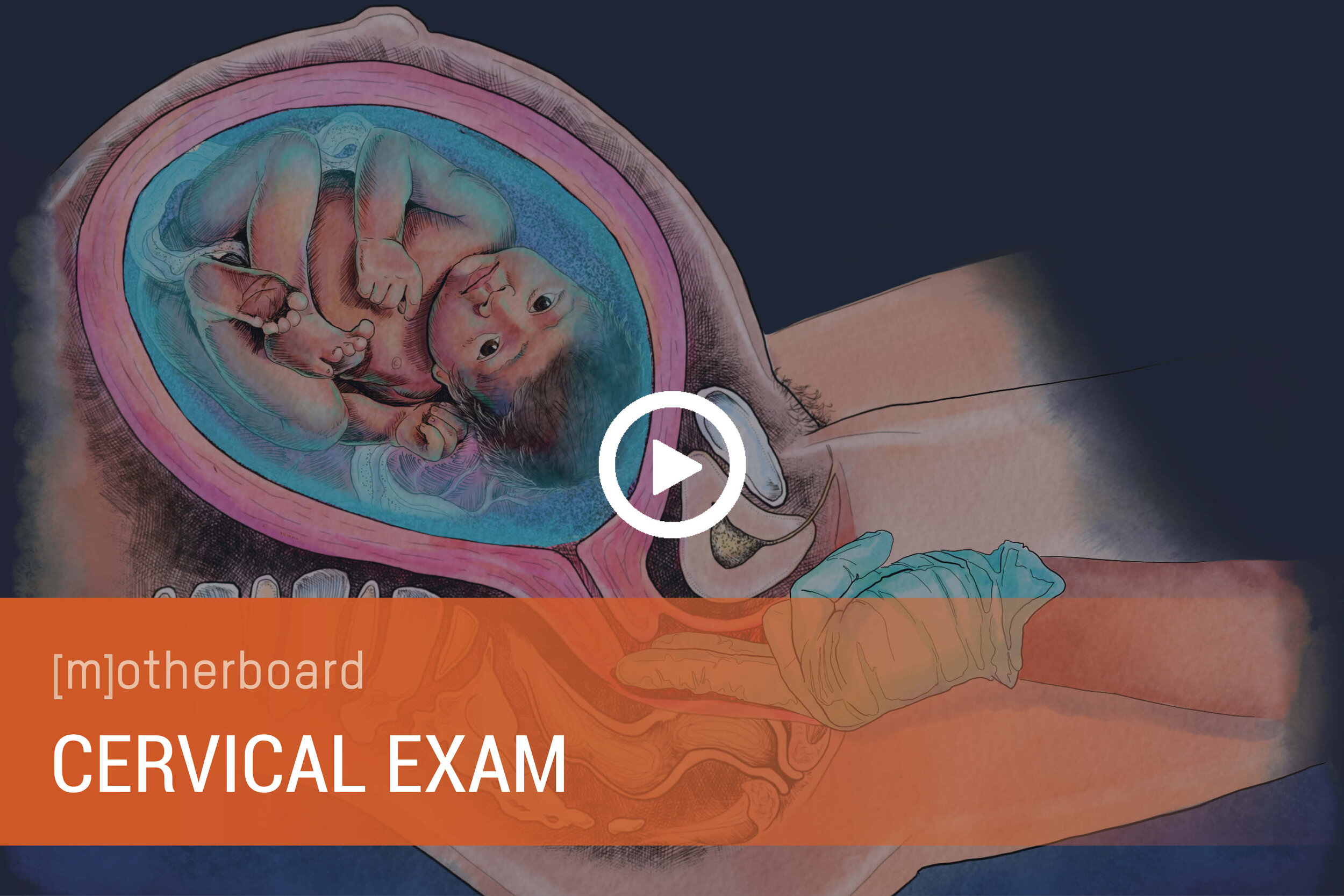 Cervical Exam Movie Covers.jpg