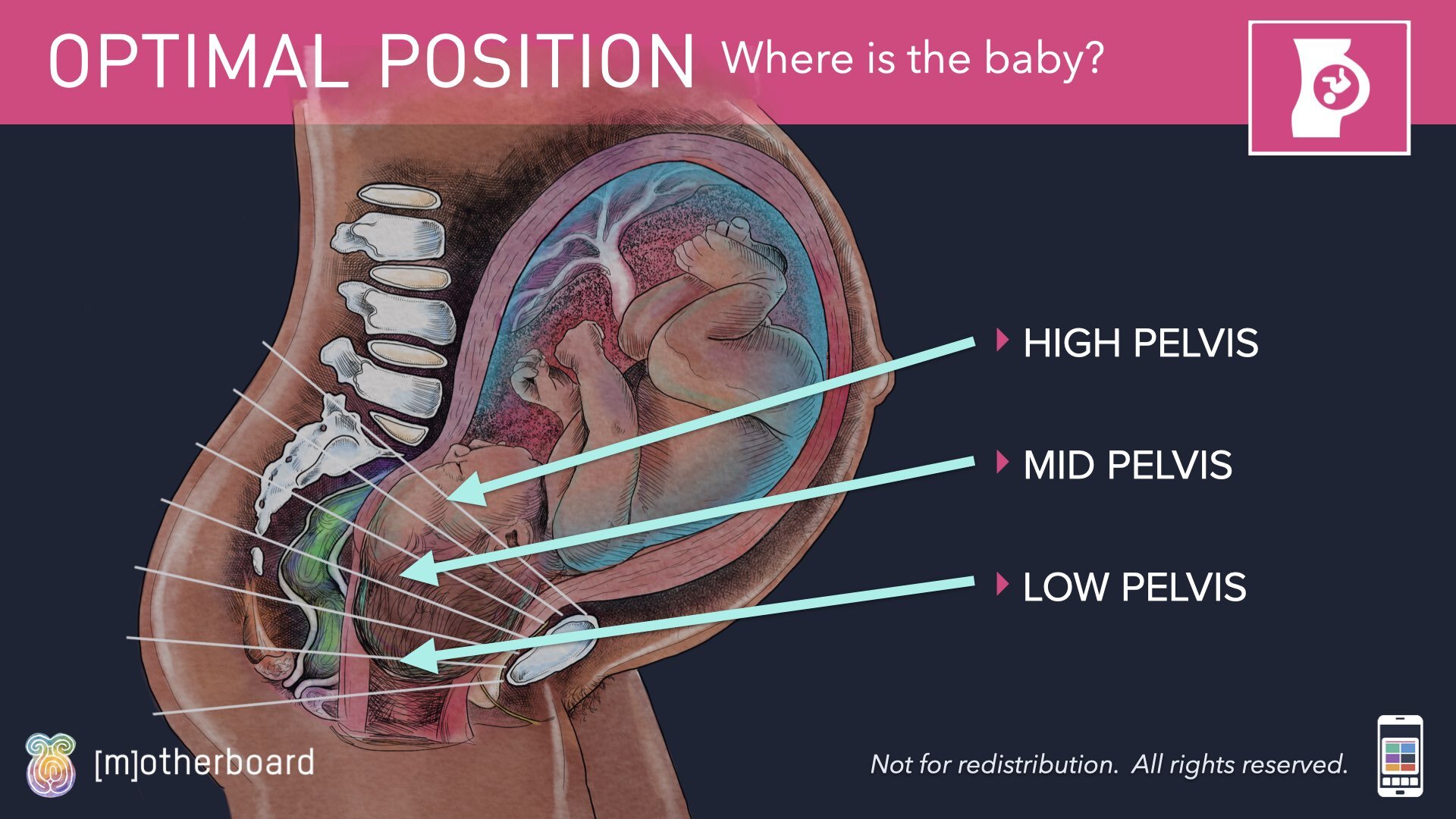 Fetal Positioning - Images.003.jpeg