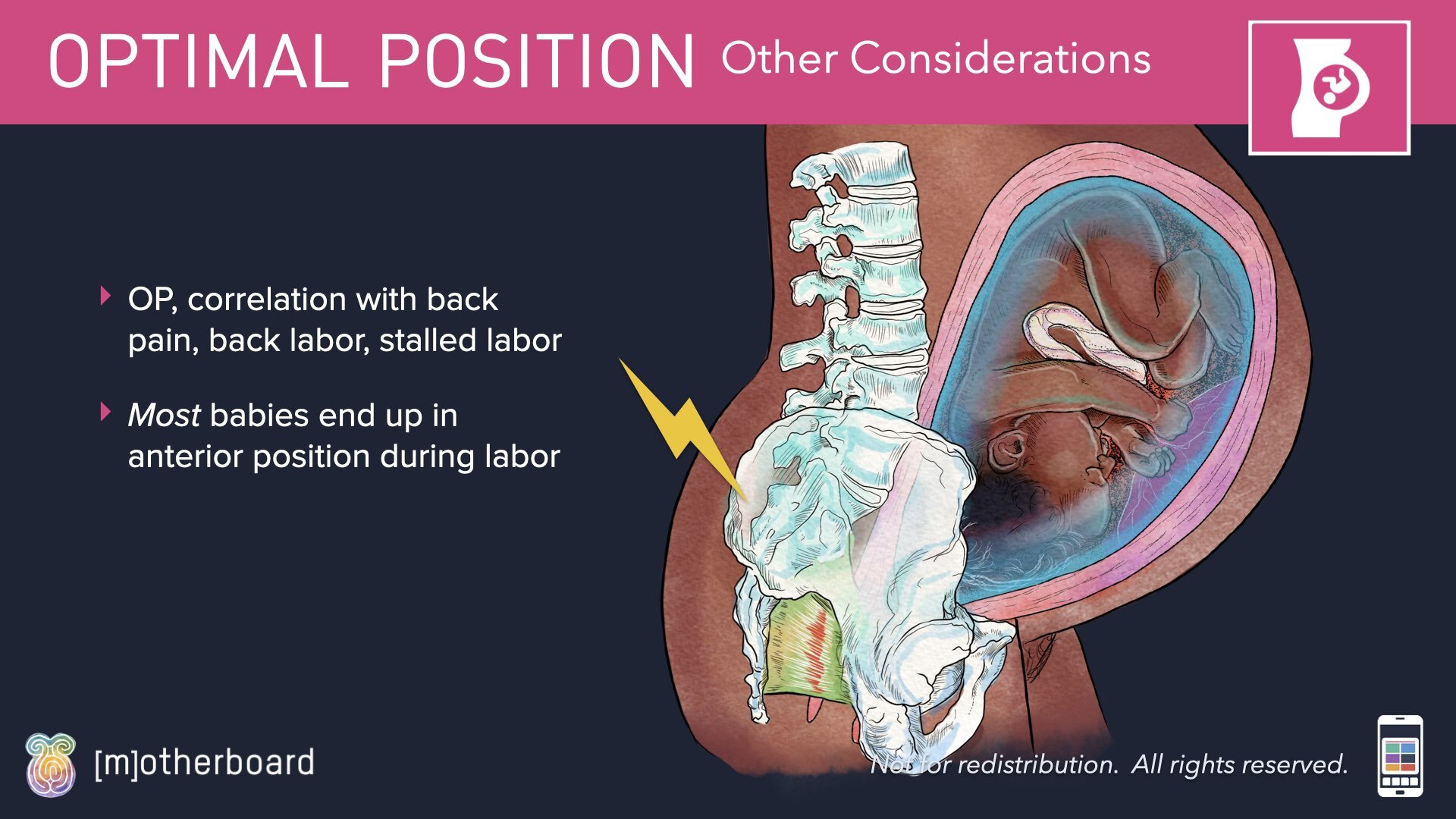 Fetal Positioning - Images.009.jpeg