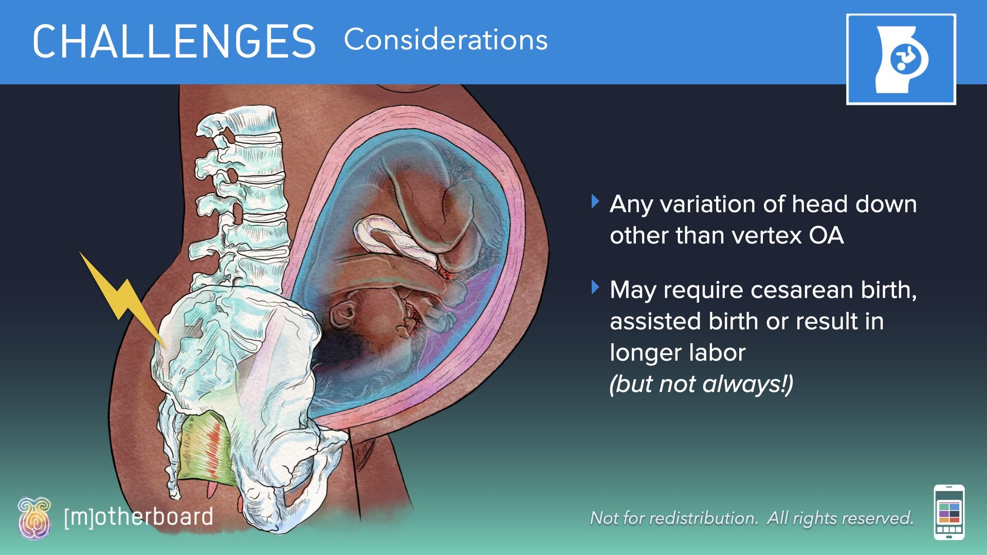 Fetal Positioning - Images.016.jpeg