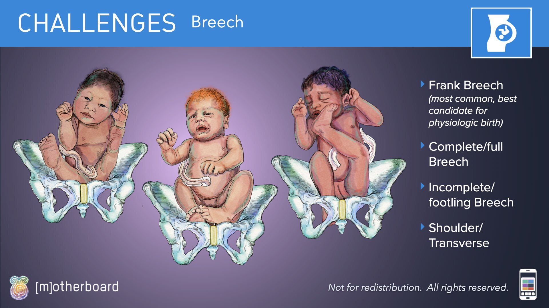 Fetal Positioning - Images.017.jpeg