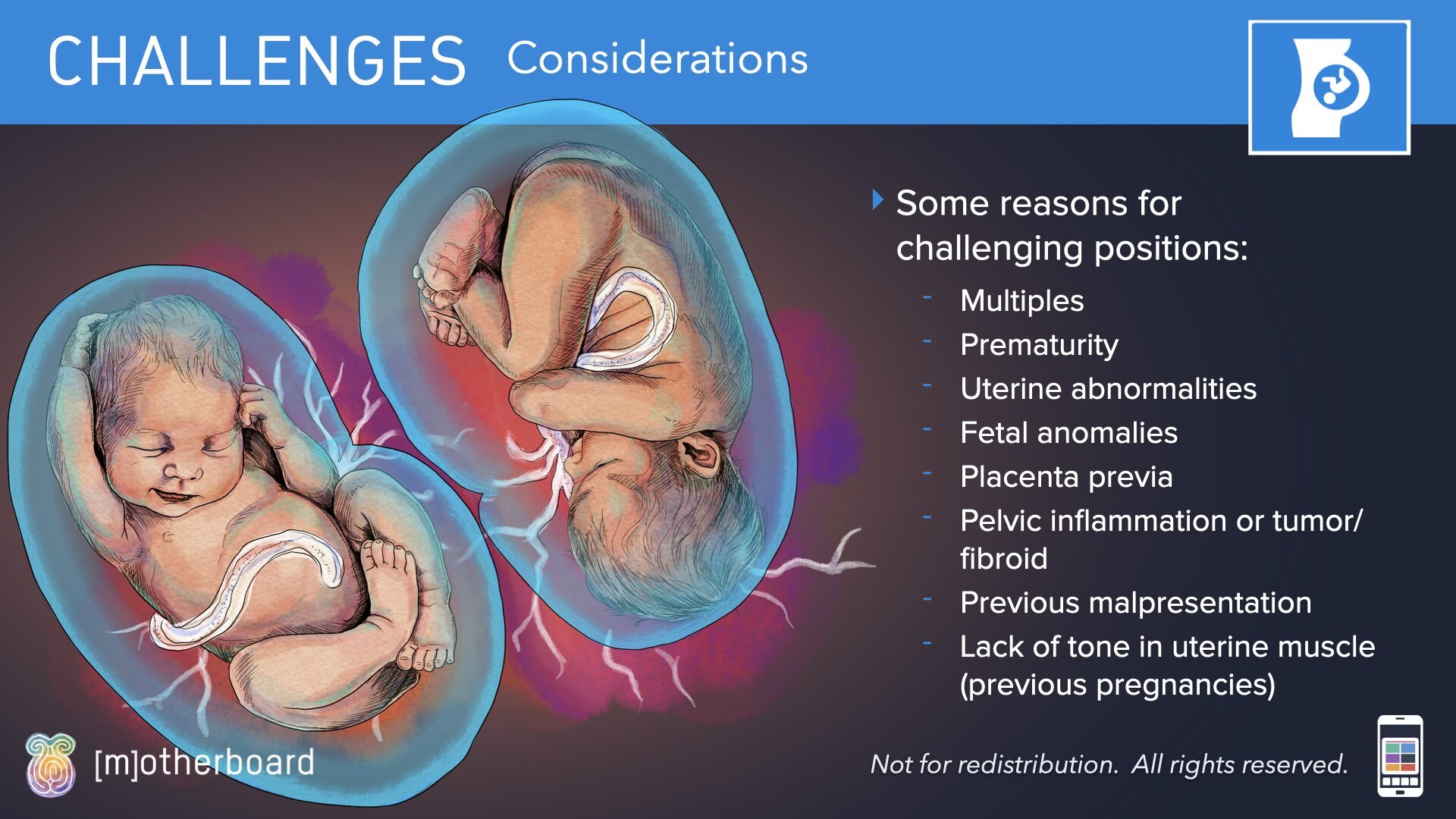 Fetal Positioning - Images.021.jpeg