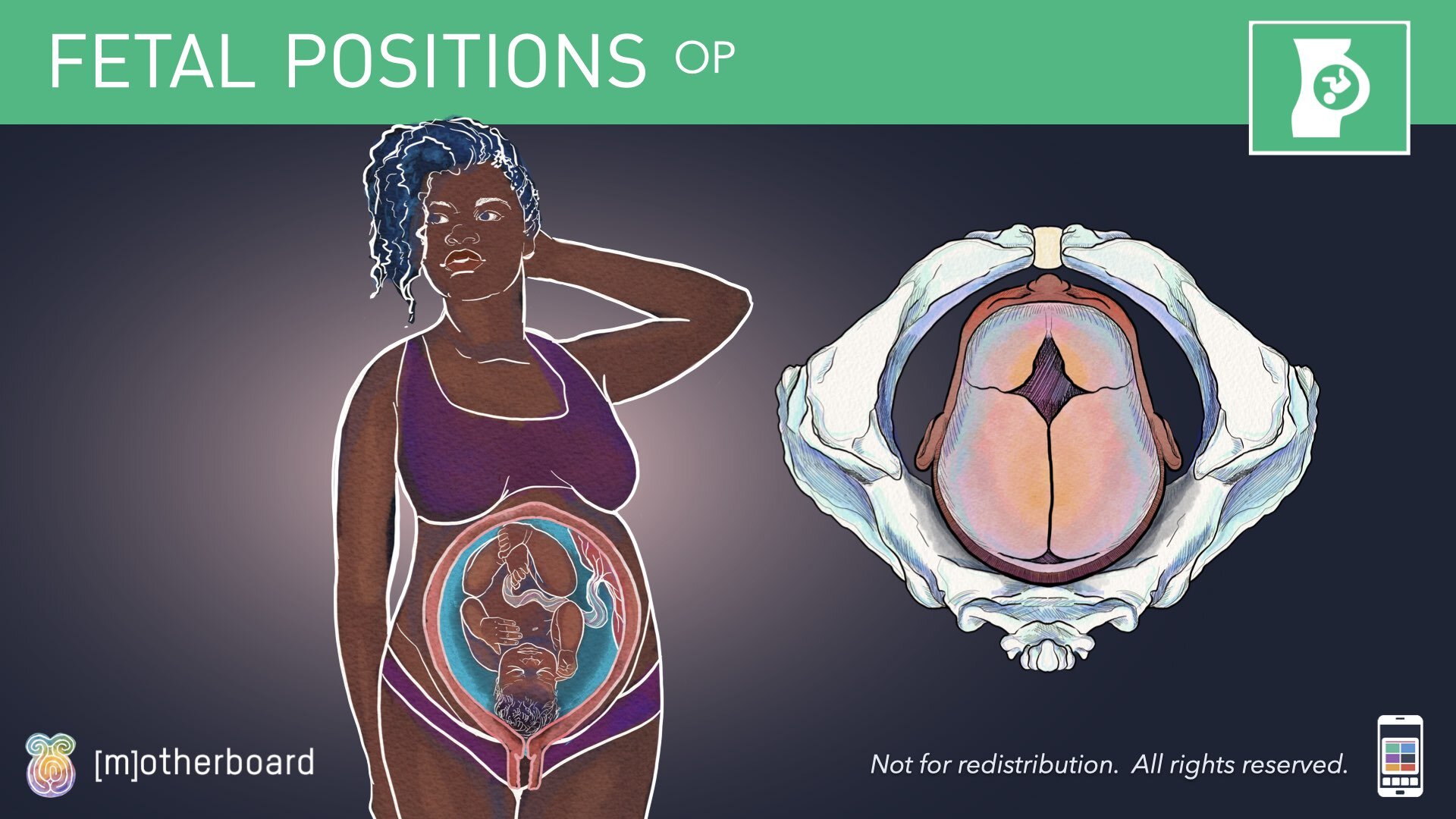 Fetal Positioning - Images.033.jpeg