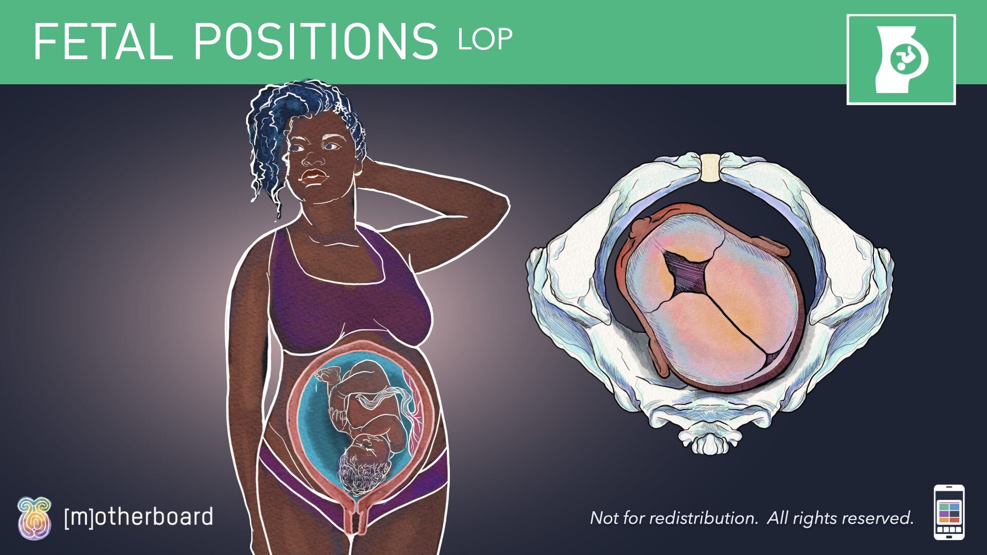 Fetal Positioning - Images.032.jpeg