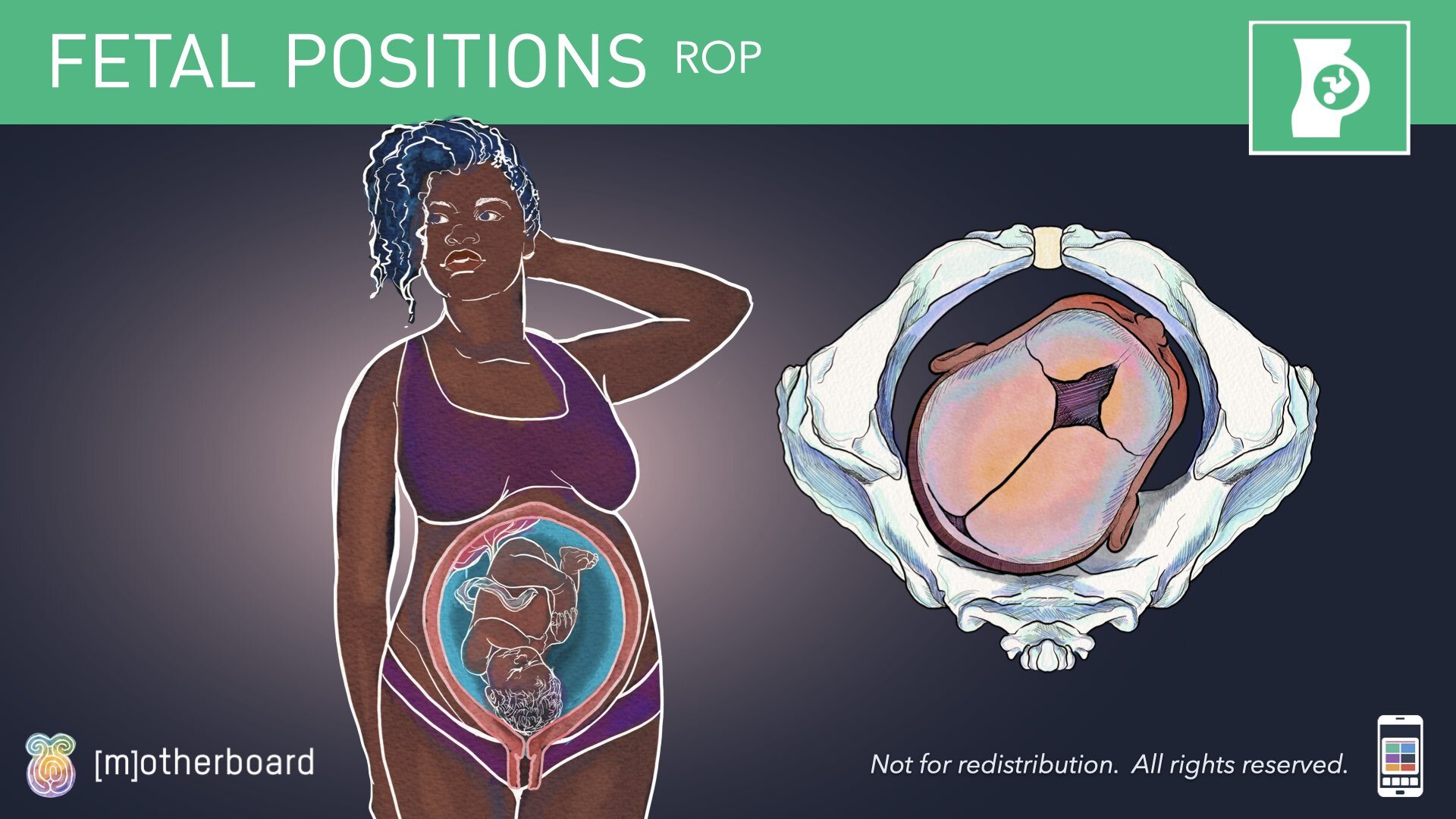Fetal Positioning - Images.034.jpeg