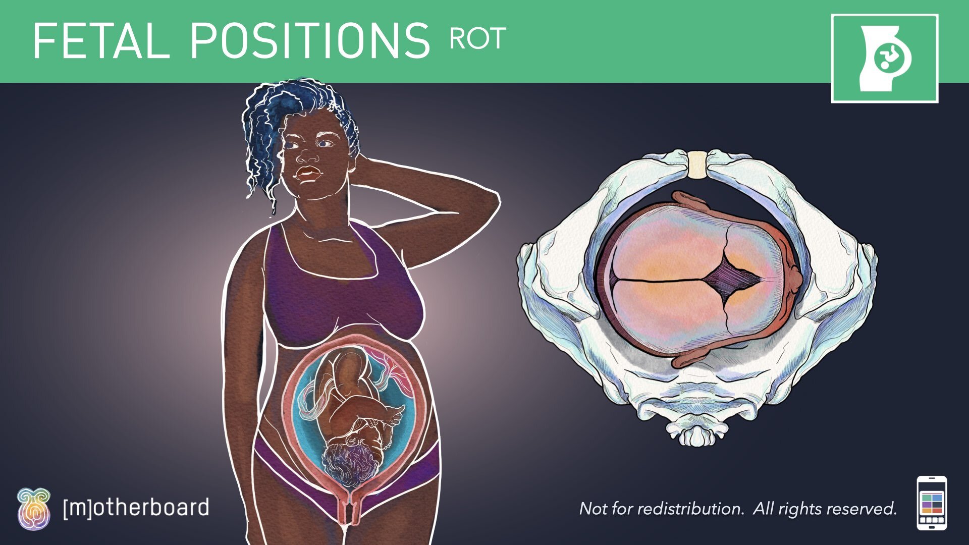 Fetal Positioning - Images.035.jpeg