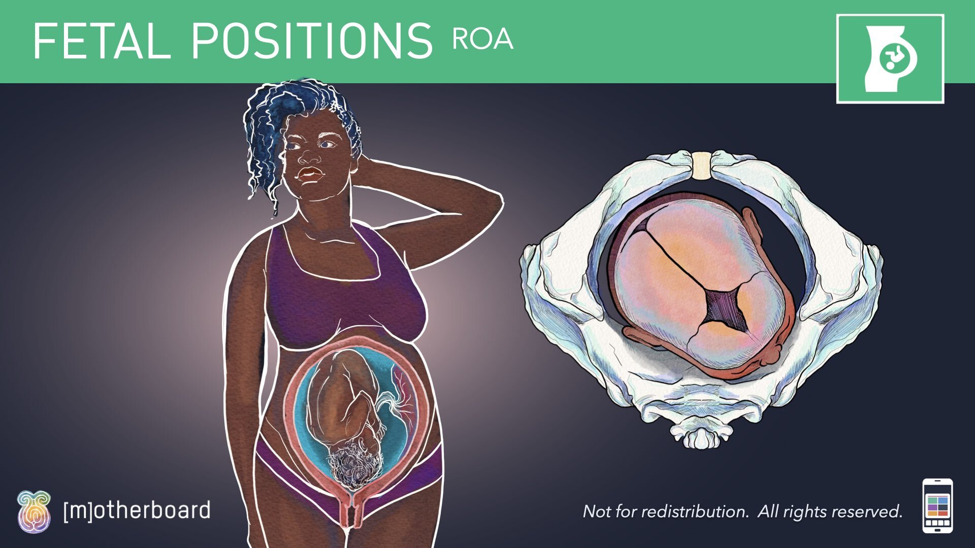 Fetal Positioning - Images.036.jpeg