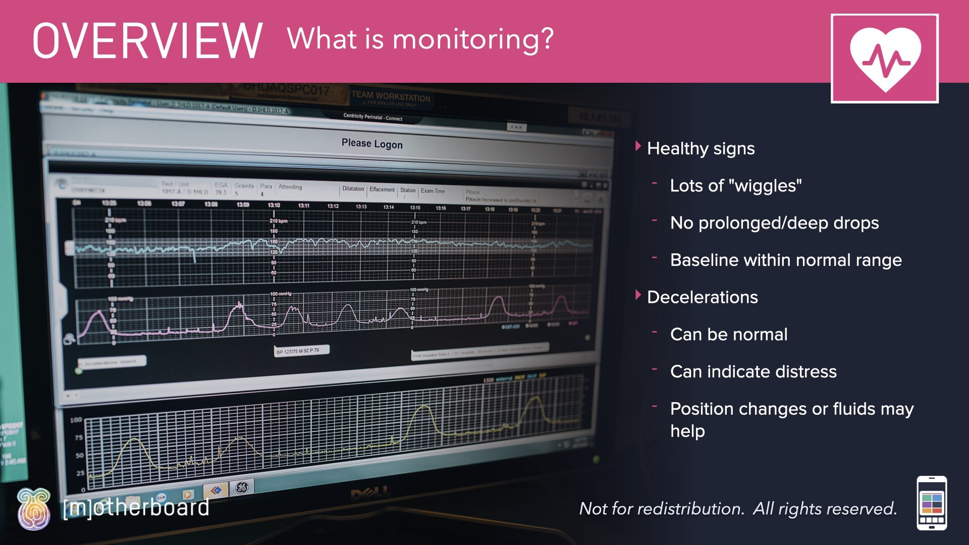 Fetal Monitoring Images.003.jpeg