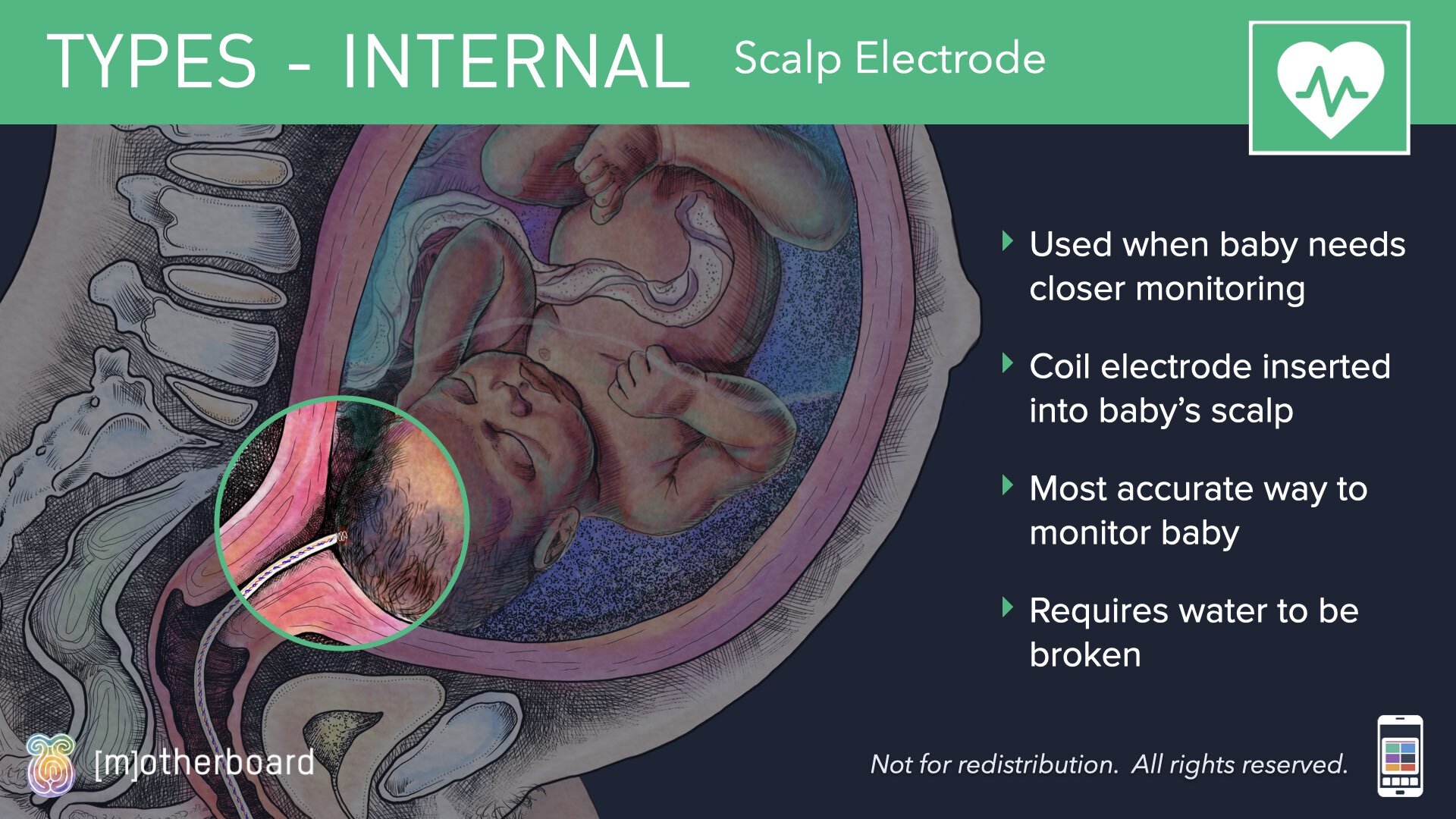 Fetal Monitoring Images.009.jpeg