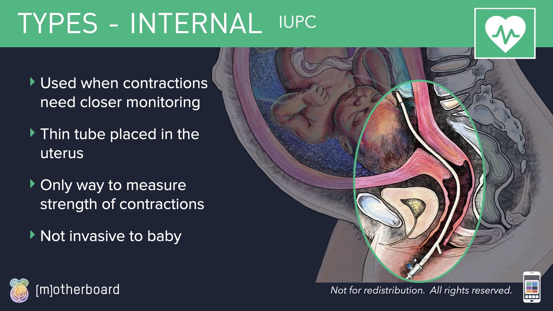Fetal Monitoring Images.010.jpeg