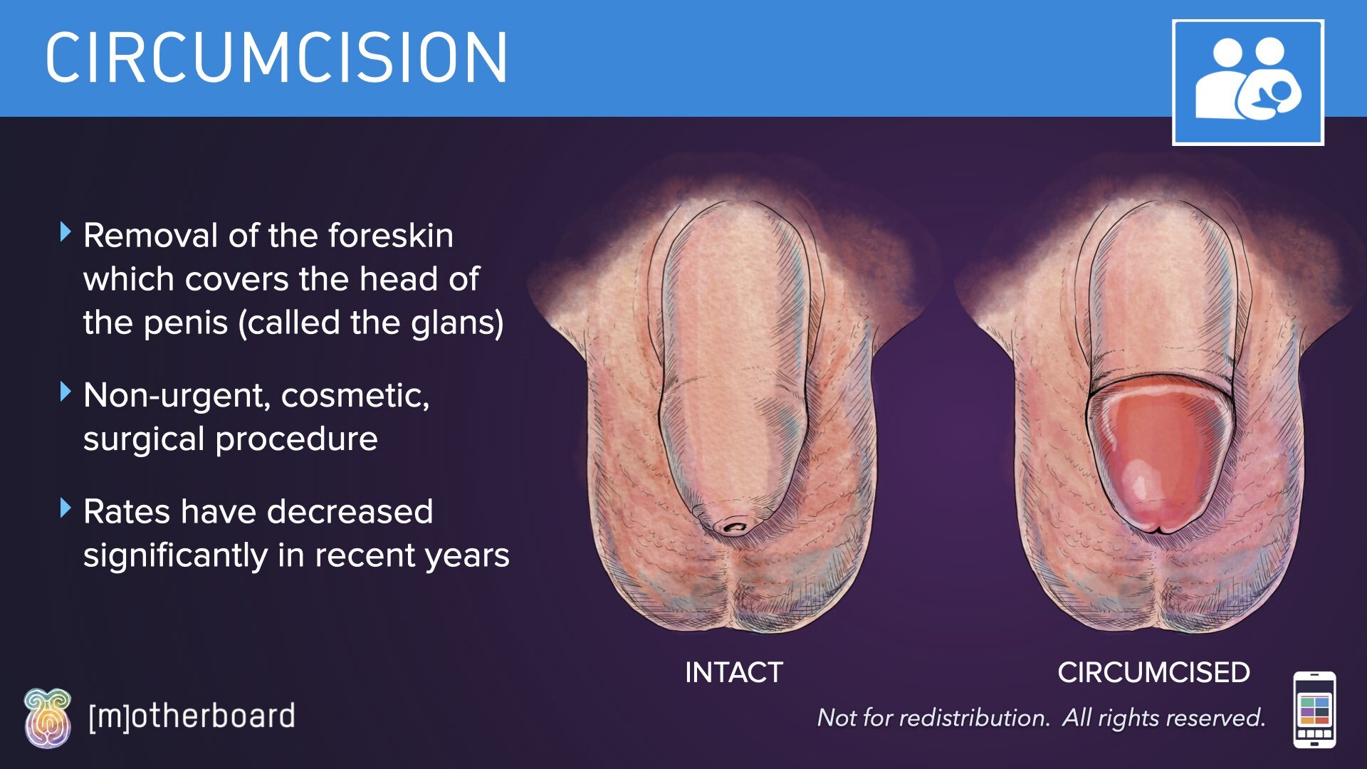 Circumcision Images.005.jpeg