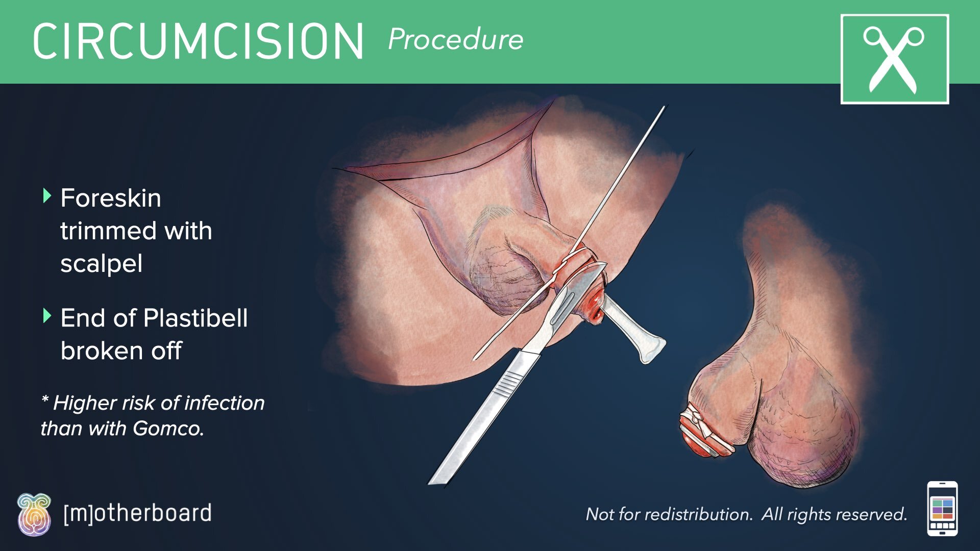 Circumcision Images.012.jpeg