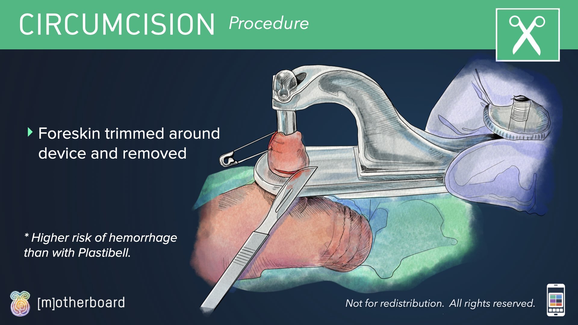 Circumcision Images.014.jpeg