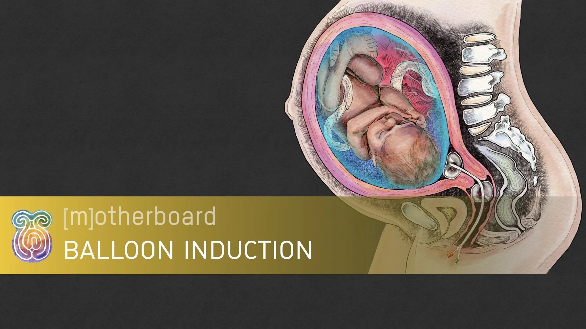 Induction - Balloon.001.jpeg