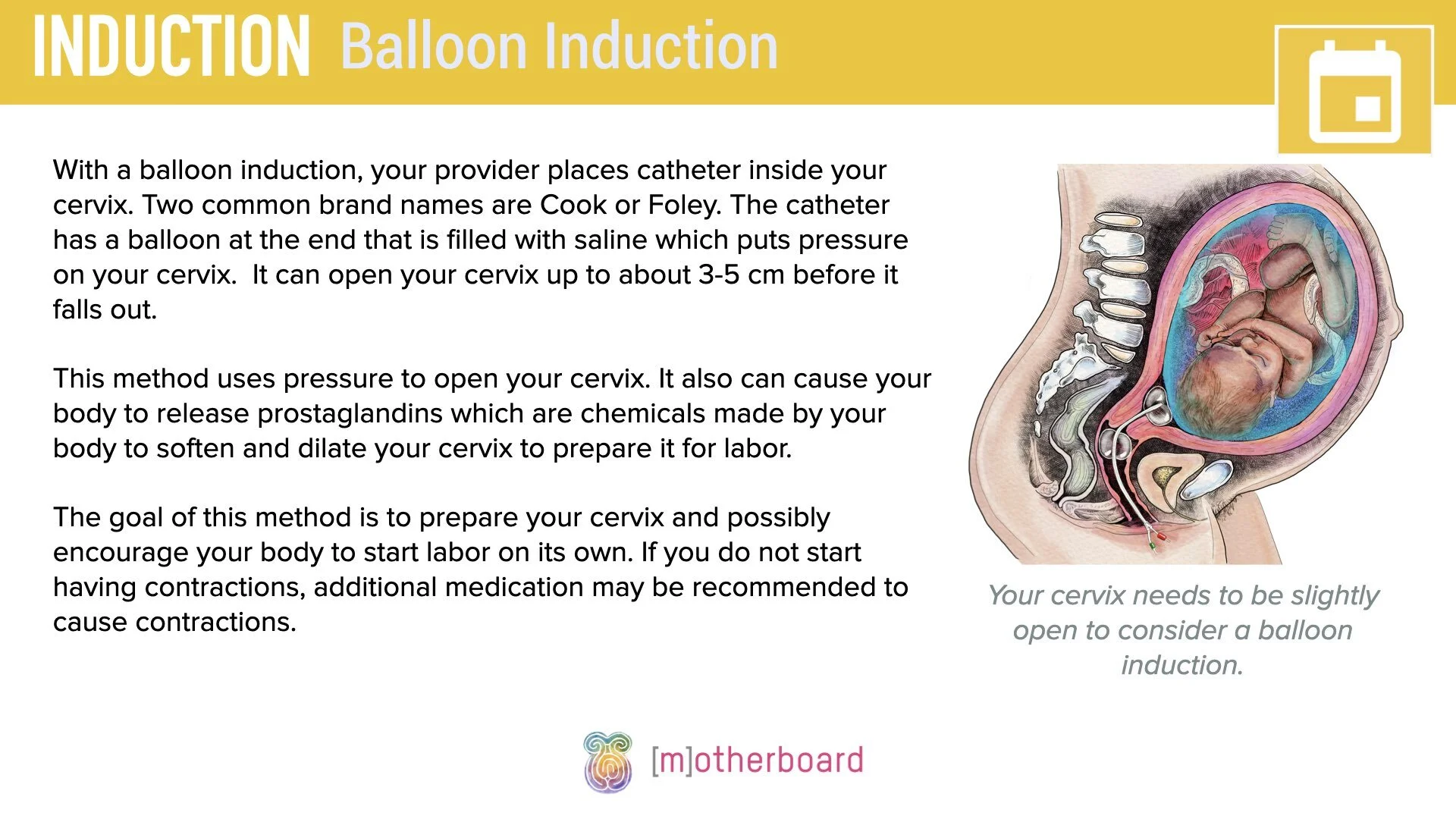 Induction - Balloon.002.jpeg
