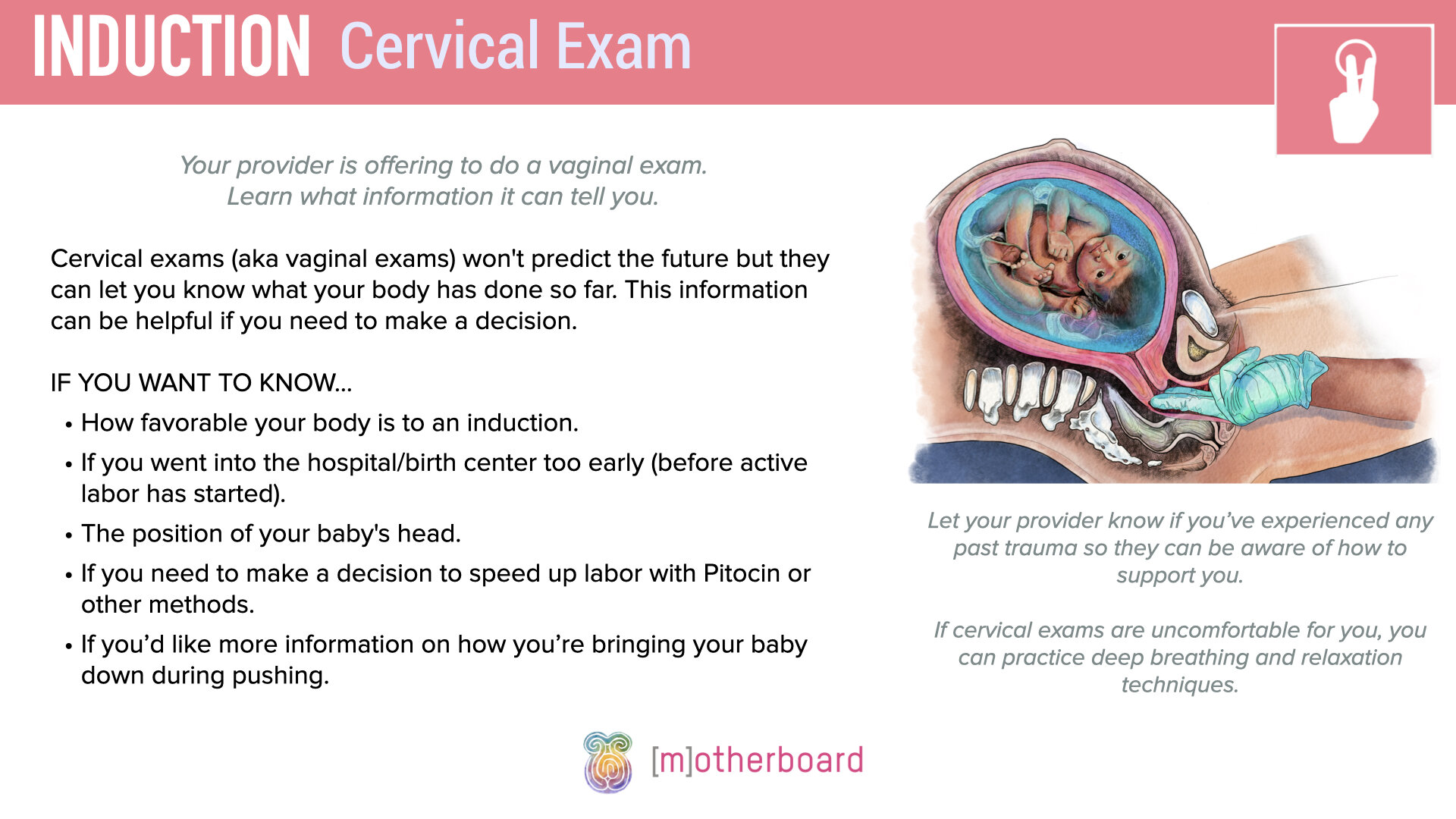 Induction - Cervical Exam.002.jpeg