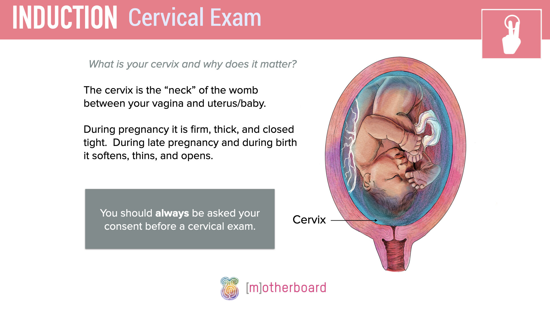 Induction - Cervical Exam.003.jpeg
