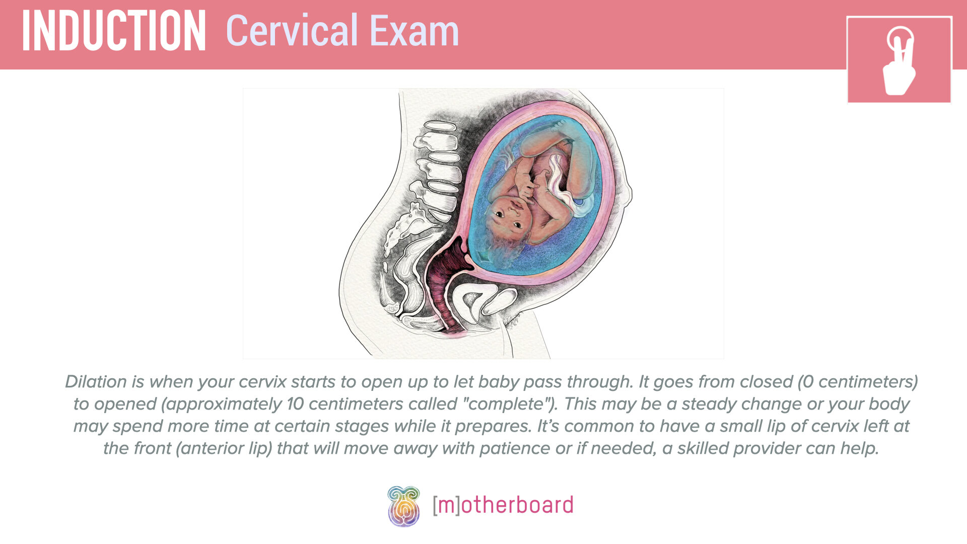 Induction - Cervical Exam.005.jpeg