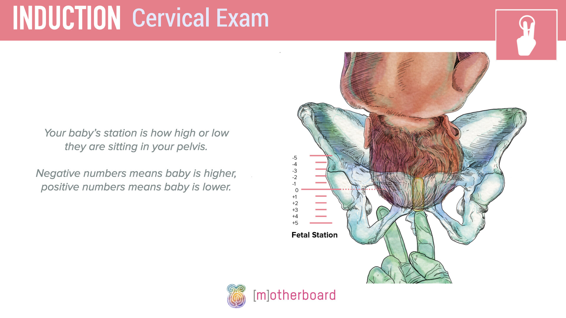 Induction - Cervical Exam.006.jpeg