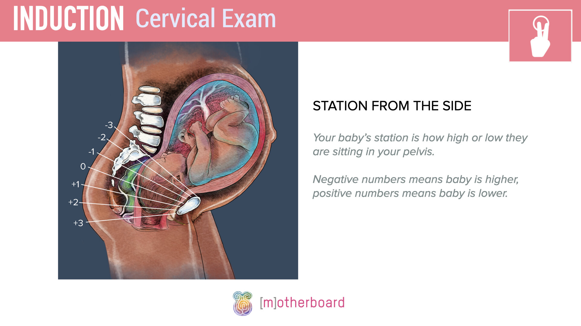 Induction - Cervical Exam.007.jpeg