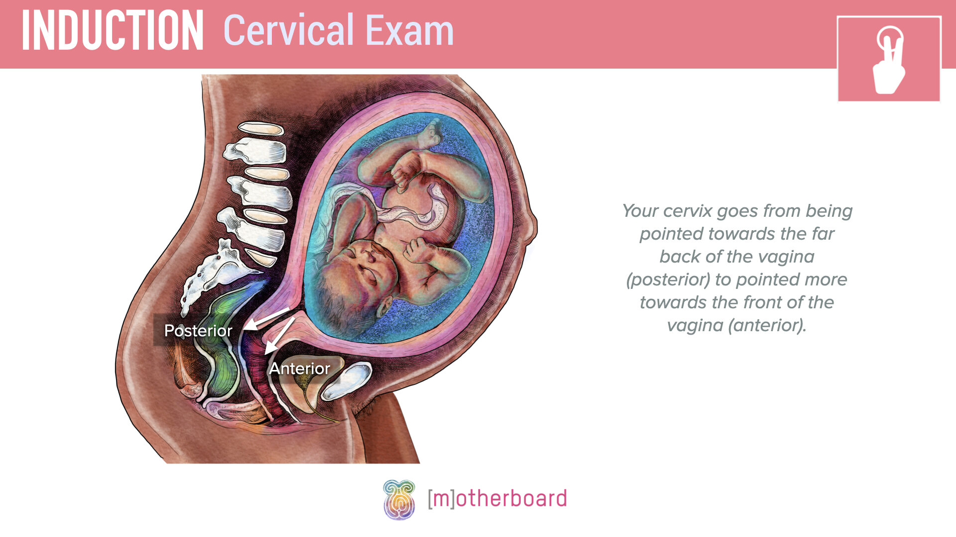 Induction - Cervical Exam.008.jpeg