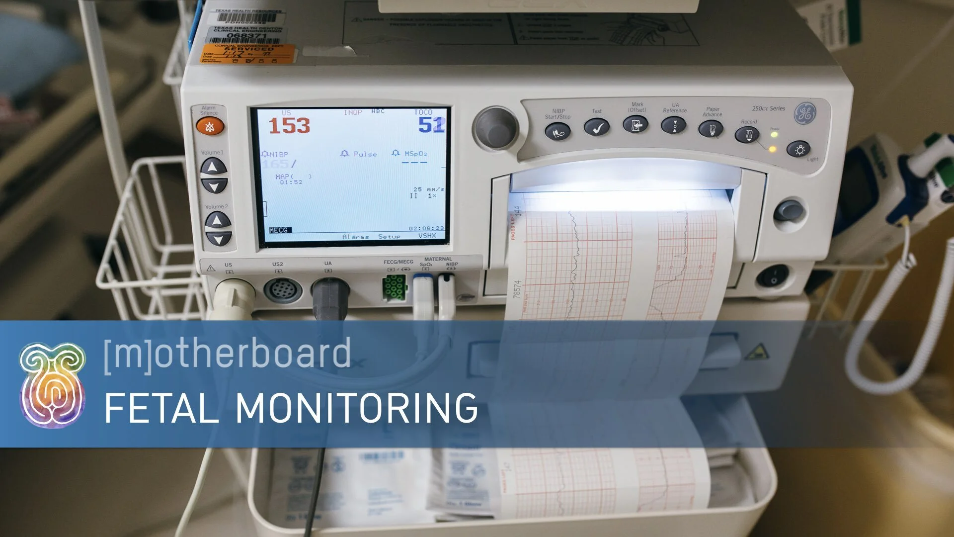 Labor - Fetal Monitoring.001.jpeg