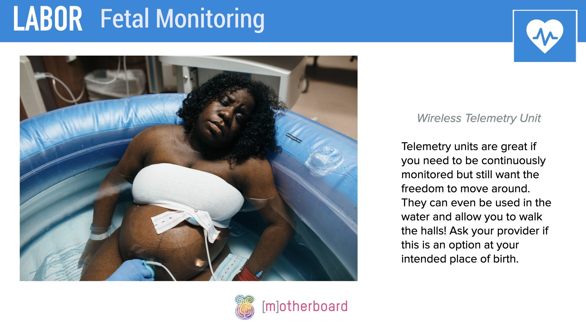 Labor - Fetal Monitoring.006.jpeg