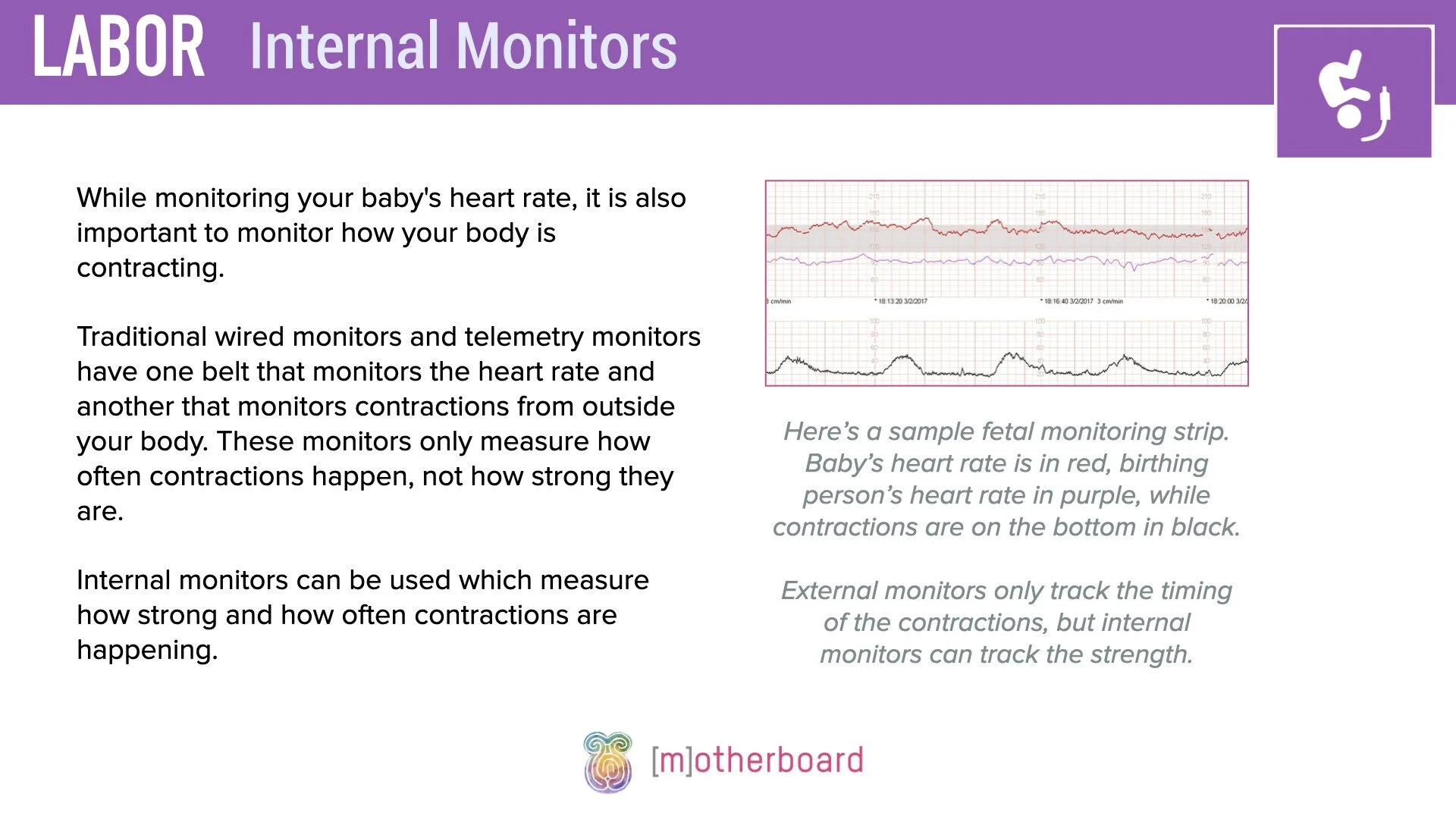 Labor - Internal Monitors.002.jpeg