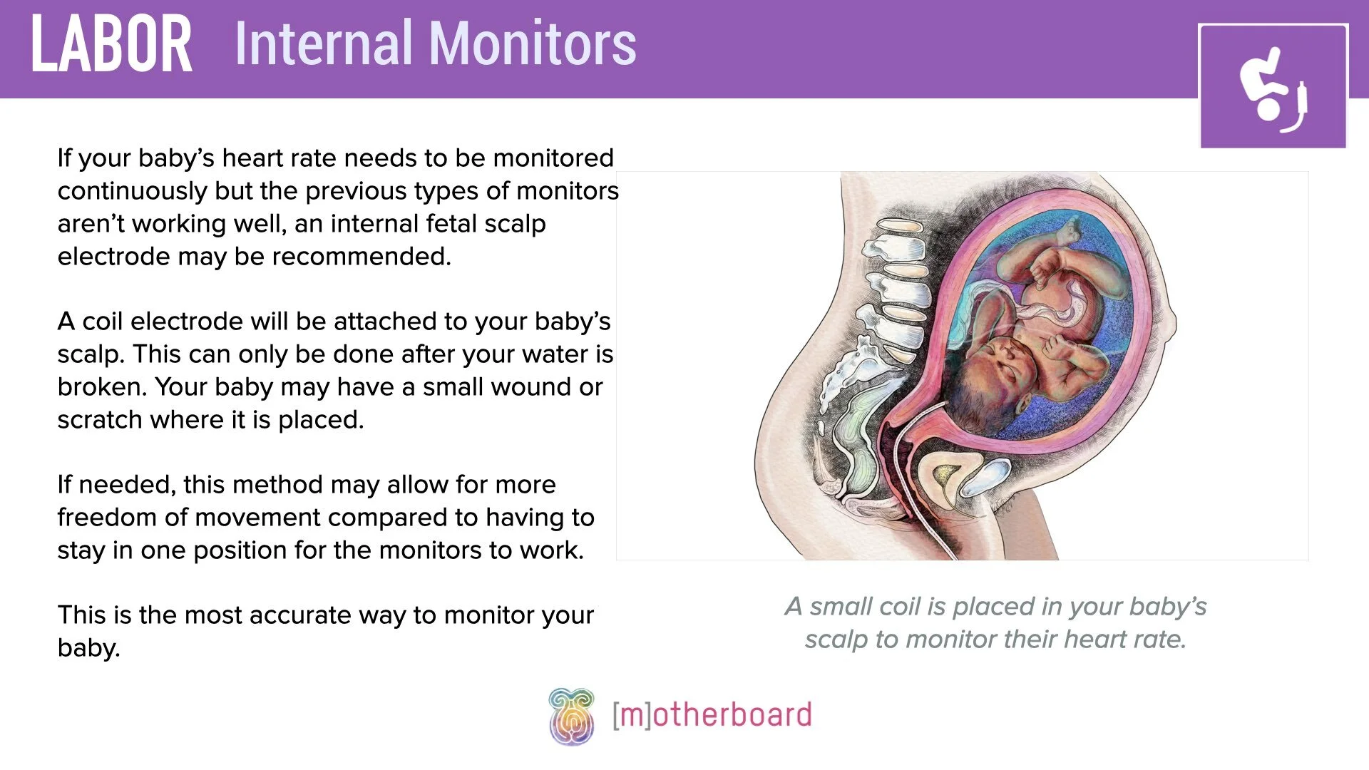 Labor - Internal Monitors.001.jpeg