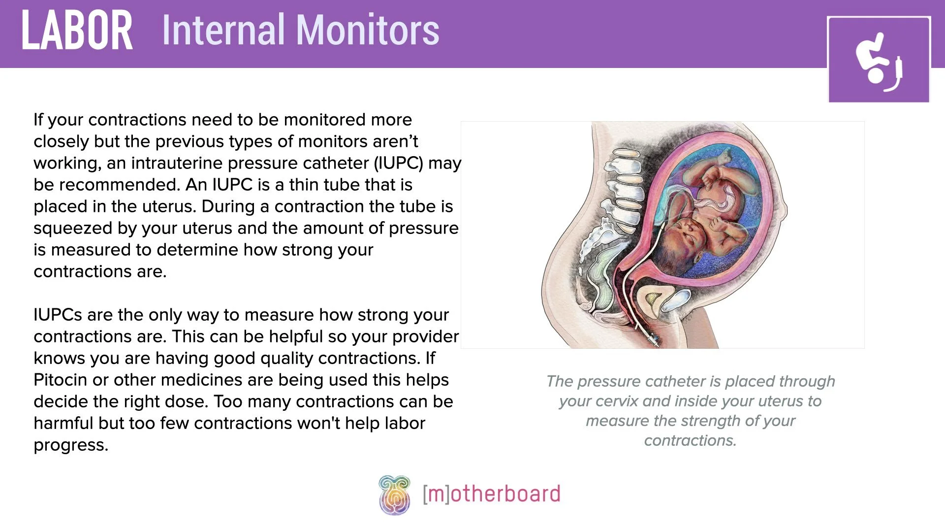 Labor - Internal Monitors.003.jpeg