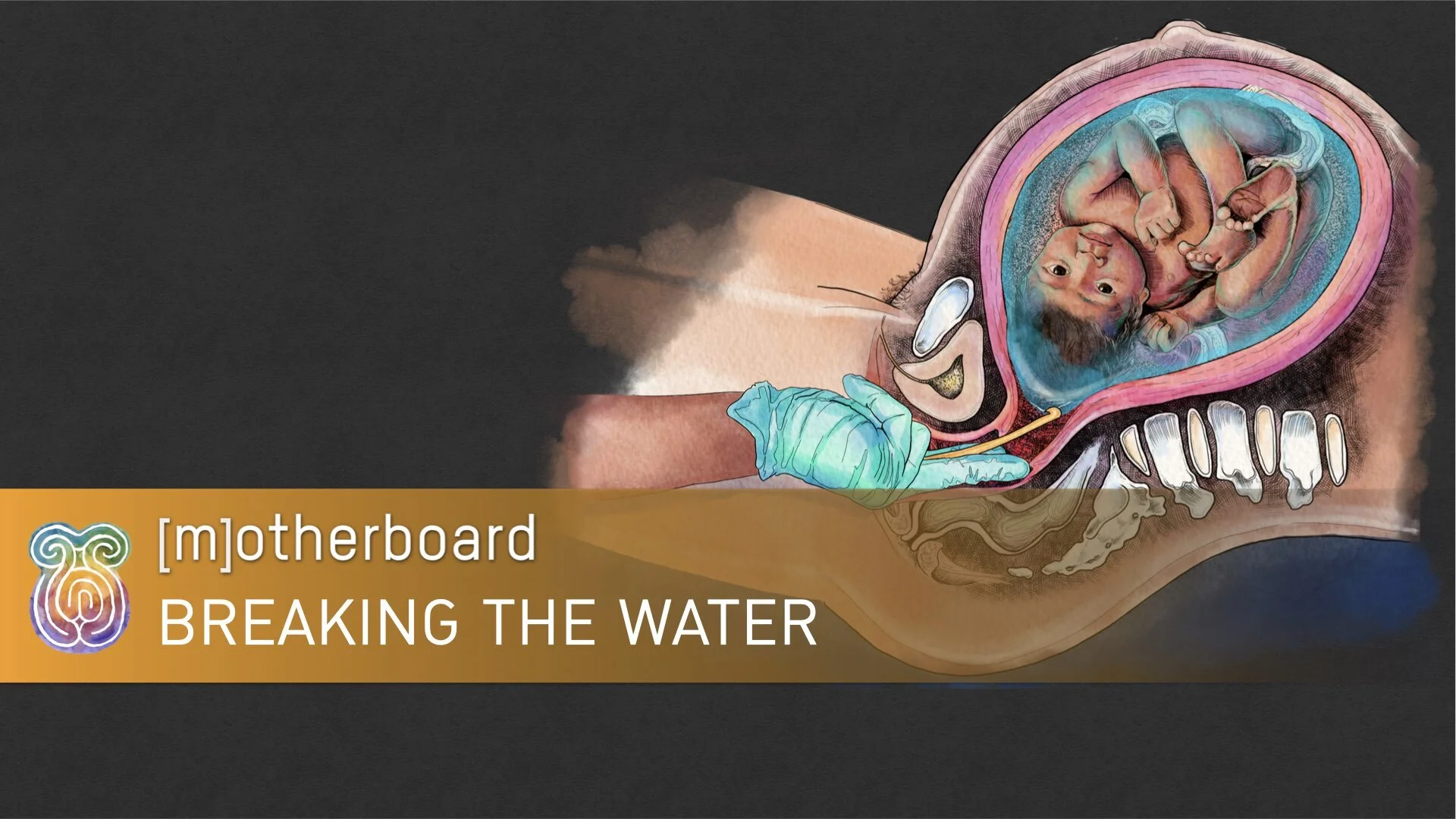 Labor - AROM.001.jpeg