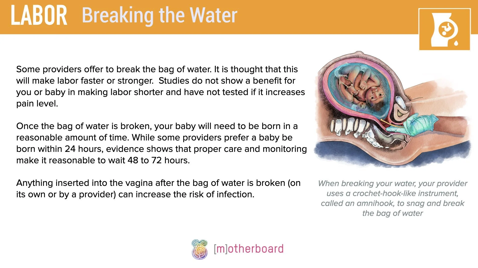 Labor - AROM.002.jpeg