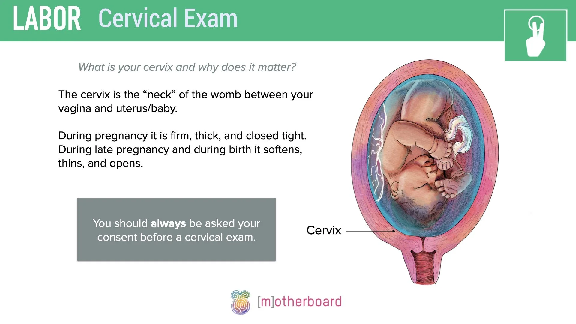 Labor - Cervical Exam.003.jpeg